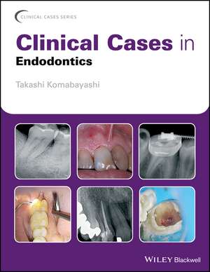 Clinical Cases in Endodontics de T Komabayashi