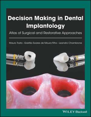 Decision Making in Dental Implantology – Atlas of Surgical and Restorative Approaches de M Tosta