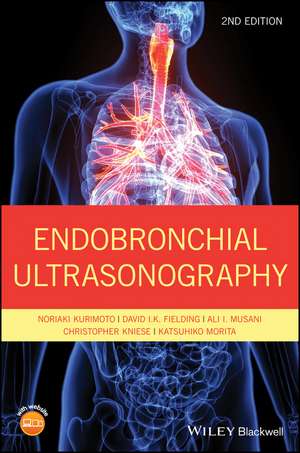 Endobronchial Ultrasonography 2e de N Kurimoto