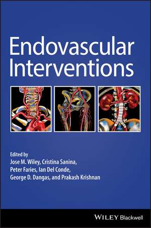 Endovascular Interventions de J Wiley