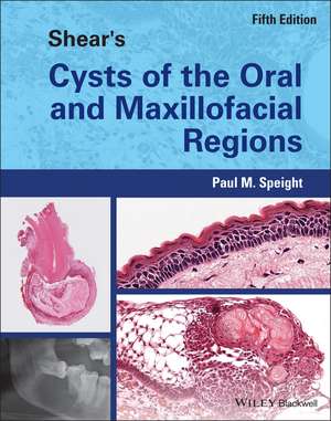 Shear′s Cysts of the Oral and Maxillofacial Region s 5th Edition de PM Speight