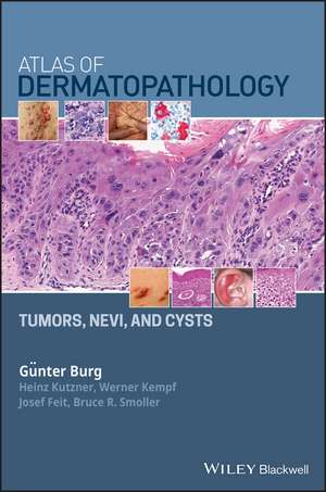 Atlas of Dermatopathology Tumors, Nevi, and Cysts de G Burg