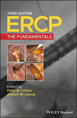 ERCP: The Fundamentals de PB Cotton