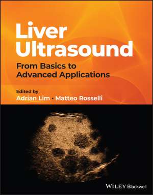 Liver Ultrasound: From Basics to Advanced Applicat ions de A Lim