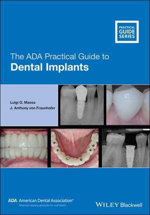 The ADA Practical Guide to Dental Implants de Luigi O. Massa