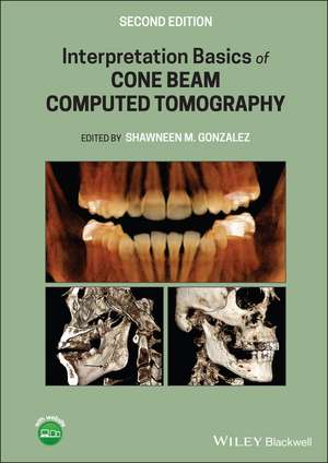 Interpretation Basics of Cone Beam Computed Tomography de SM Gonzalez