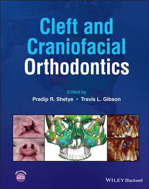 Cleft and Craniofacial Orthodontics de PR Shetye