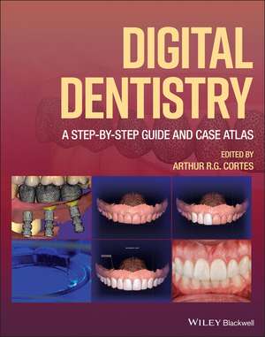 Digital Dentistry: A Step–by–Step Guide and Case Atlas de ARG Cortes