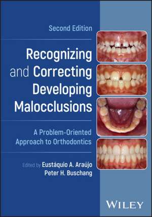 Recognizing and Correcting Developing Malocclusions de Eustaquio A. Araujo