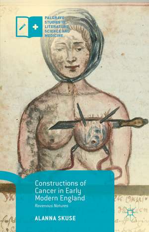 Constructions of Cancer in Early Modern England: Ravenous Natures de Alanna Skuse