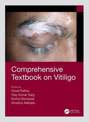 Comprehensive Textbook on Vitiligo de Vineet Relhan