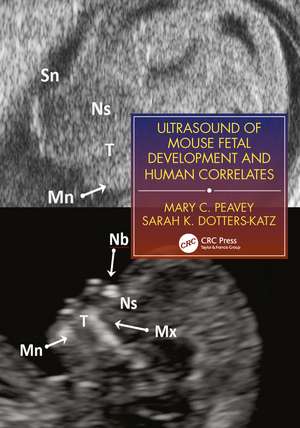 Ultrasound of Mouse Fetal Development and Human Correlates de Mary C. Peavey