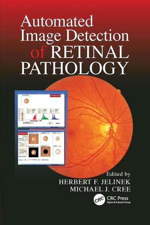 Automated Image Detection of Retinal Pathology de Herbert Jelinek