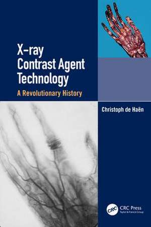 X-ray Contrast Agent Technology: A Revolutionary History de Christoph de Haen