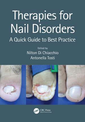 Therapies for Nail Disorders: A Quick Guide to Best Practice de Nilton Di Chiacchio