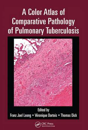 A Color Atlas of Comparative Pathology of Pulmonary Tuberculosis de Franz Joel Leong