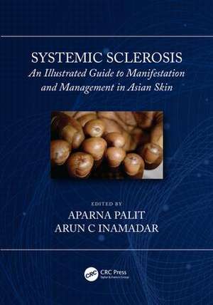 Systemic Sclerosis: An Illustrated Guide to Manifestation and Management in Asian Skin de Arun C Inamadar