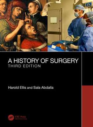 A History of Surgery: Third Edition de Harold Ellis