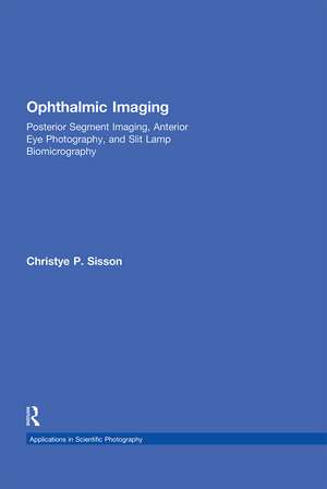 Ophthalmic Imaging: Posterior Segment Imaging, Anterior Eye Photography, and Slit Lamp Biomicrography de Christye Sisson