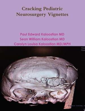 Cracking Pediatric Neurosurgery Vignettes de Paul Edward Kaloostian MD