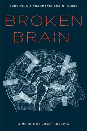 Broken Brain de Joseph Huerta