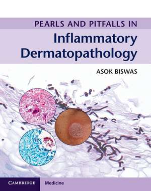 Pearls and Pitfalls in Inflammatory Dermatopathology de Asok Biswas