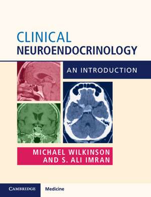 Clinical Neuroendocrinology: An Introduction de Michael Wilkinson