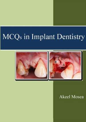 McQs in Implant Dentistry de Akeel Mosea