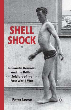 Shell Shock: Traumatic Neurosis and the British Soldiers of the First World War de P. Leese