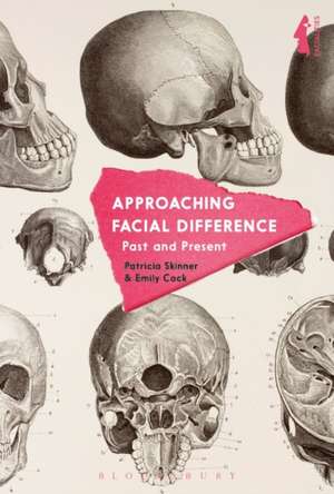 Approaching Facial Difference: Past and Present de Patricia Skinner