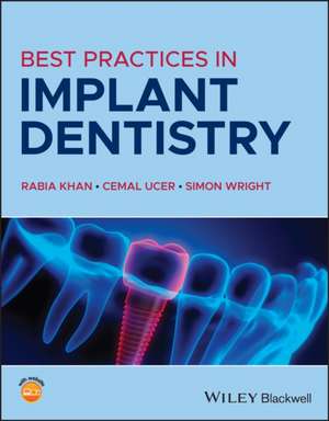 Best Practices in Implant Dentistry de Khan