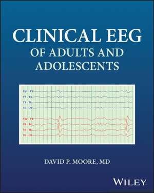 Clinical EEG of Adults and Adolescents de David Moore