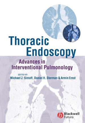 Thoracic Endoscopy de Michael J Simoff