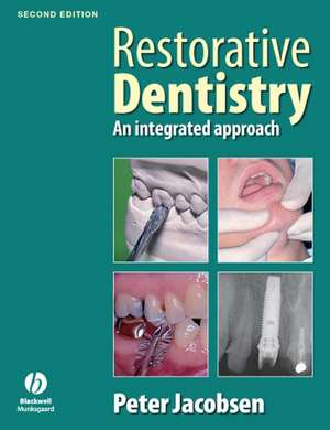 Restorative Dentistry 2e de P Jacobsen