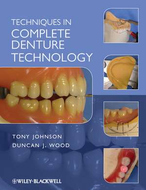 Techniques in Complete Denture Technology de T. Johnson