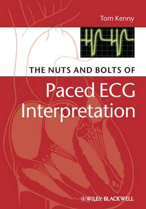 The Nuts and Bolts of Paced ECG Interpretation de T Kenny