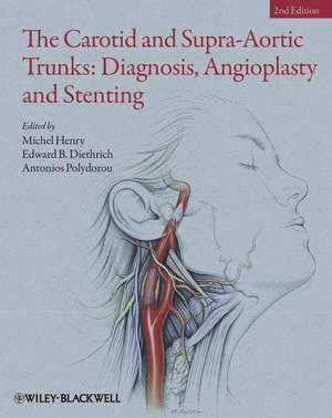 The Carotid and Supra–Aortic Trunks – Diagnosis, Angioplasty and Stenting de M. Henry