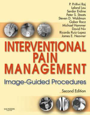 Interventional Pain Management: Image-Guided Procedures with DVD de P. Prithvi Raj