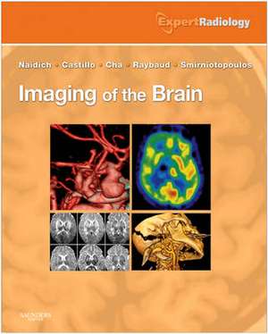 Imaging of the Brain: Expert Radiology Series de Thomas P. Naidich