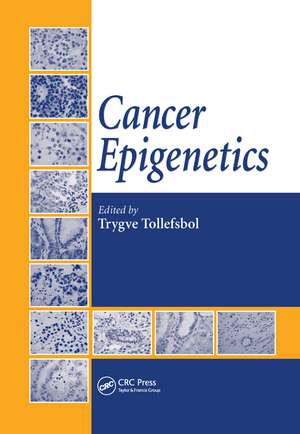 Cancer Epigenetics de Trygve Tollefsbol