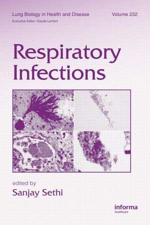 Respiratory Infections de Sanjay Sethi