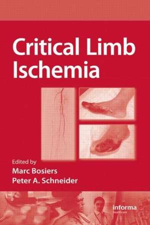 Critical Limb Ischemia de Marc Bosiers