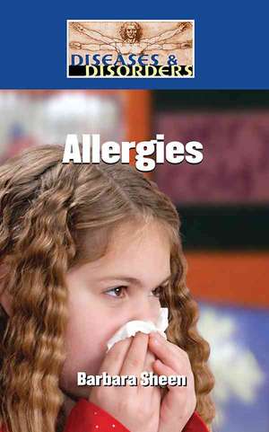 Allergies de Barbara Sheen