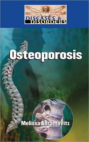 Osteoporosis de Melissa Abramovitz