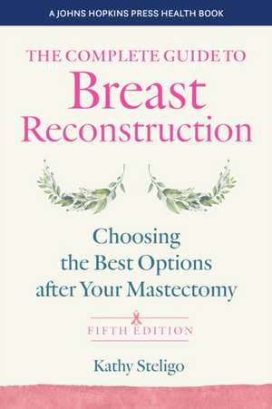 The Complete Guide to Breast Reconstruction – Choosing the Best Options after Your Mastectomy de Kathy Steligo