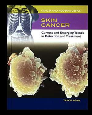 Skin Cancer: Current and Emerging Trends in Detection and Treatment de Tracie Egan