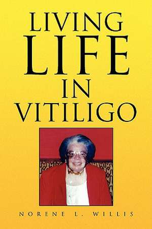 Living Life in Vitiligo de Norene L. Willis