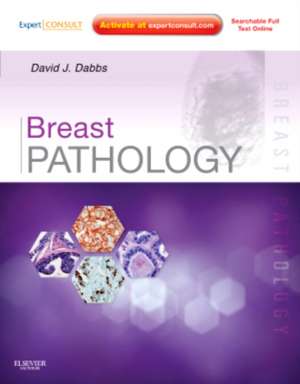 Breast Pathology: Expert Consult - Online and Print de David J Dabbs