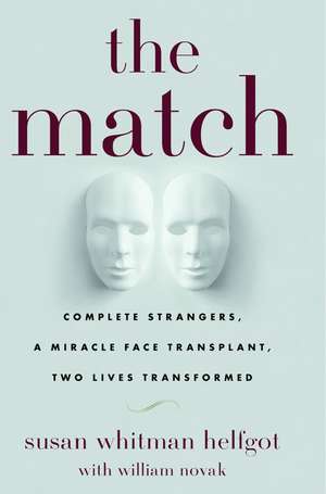 The Match: Complete Strangers, a Miracle Face Transplant, Two Lives Transformed de Susan Whitman Helfgot