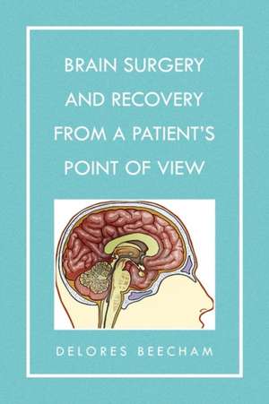 Brain Surgery and Recovery from a Patient's Point of View de Delores Beecham